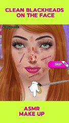 clean blackheads on the face