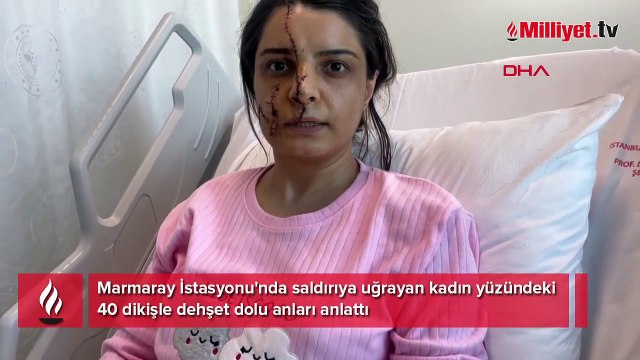 Yüzüne 40 dikiş atıldı, dehşeti anlattı: Takıntı ve saplantılı halde taciz edildi