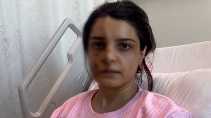 Marmaray İstasyonu'nda saldırıya uğrayan Gülhan Karadereli, o anları anlattı