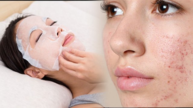 Overnight Sleeping Mask for Face Is Good Or Bad, Daily Use Side Effects | Boldsky