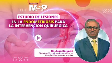 Estudio de lesiones en la endometriosis para intervención quirúrgica - #ExclusivoMSP