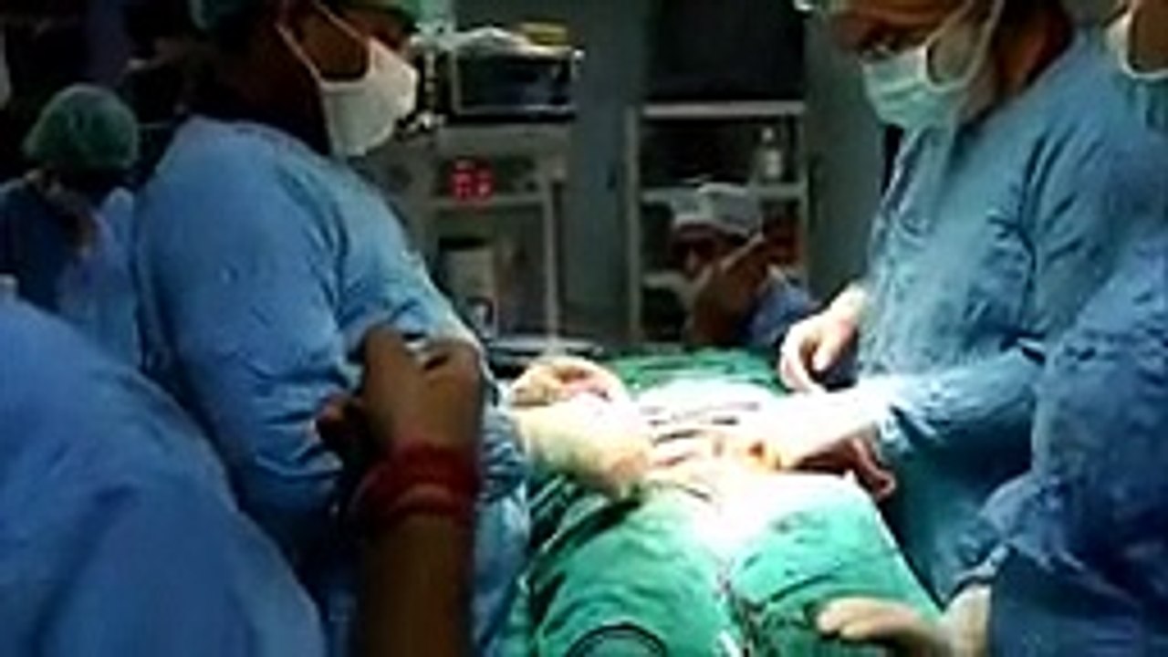 Open myomectomy is better for multiple huge intramural fibroid