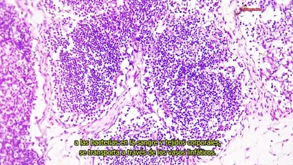 ¿Cómo funciona el sistema linfático? -#ExclusivoMSP