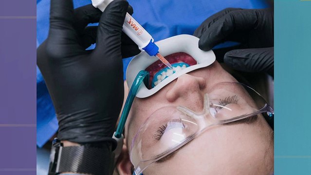 bd-causas-de-dientes-amarillos-y-cómo-corregirlo-190324