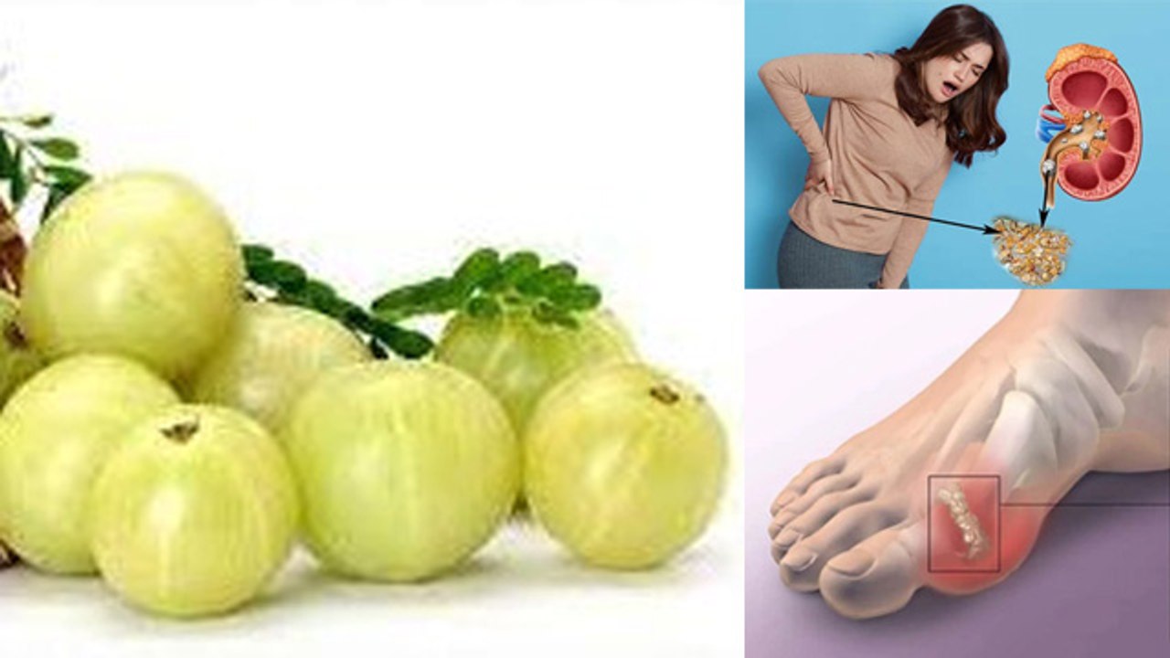 High Uric Acid Me Amla Khana Chahiye Ki Nahi | हाई यूरिक एसिड में आंवला खाना चाहिए कि नहीं | Boldsky