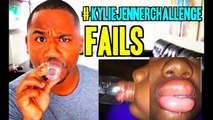 El famoso reto de labios de Kylie Jenner