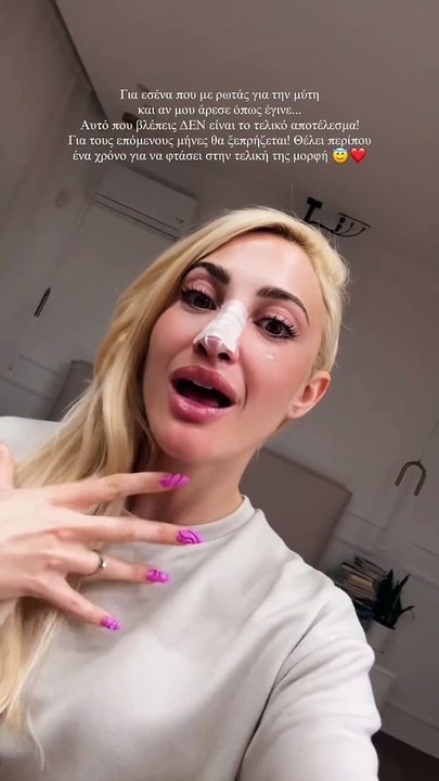 Ιωάννα Τούνη: Έτσι είναι μετά την επέμβαση στη μύτη - «Ελπίζω να μην είναι το τελικό αποτέλεσμα»