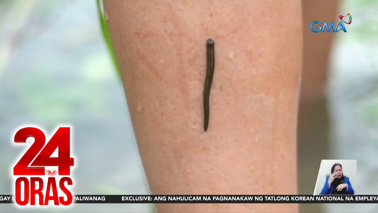 Hiker sa CamSur, pinasok ng linta o limatik ang mata | 24 Oras - video ...