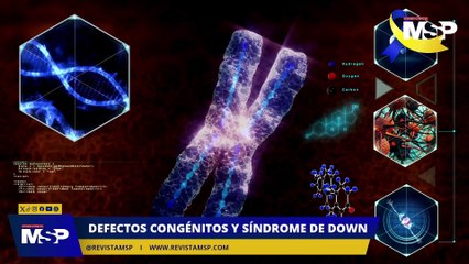 Defectos congénitos y síndrome de down - #ExclusivoMSP