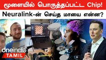 Elon Musk's Neuralink-ன் 1st Patient! Brain Chip செய்த Miracle | Oneindia Tamil