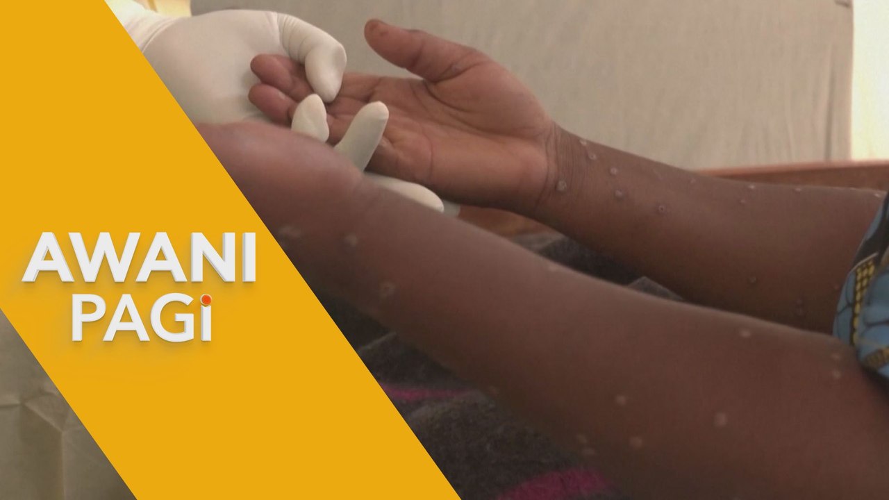 AWANI Pagi: Memahami vaksinasi Mpox