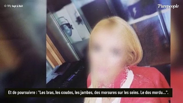 Affaire Jegou-Auradou : le père de la victime présumée s'exprime... Il n'y a pas un endroit où il n'y avait pas un bleu