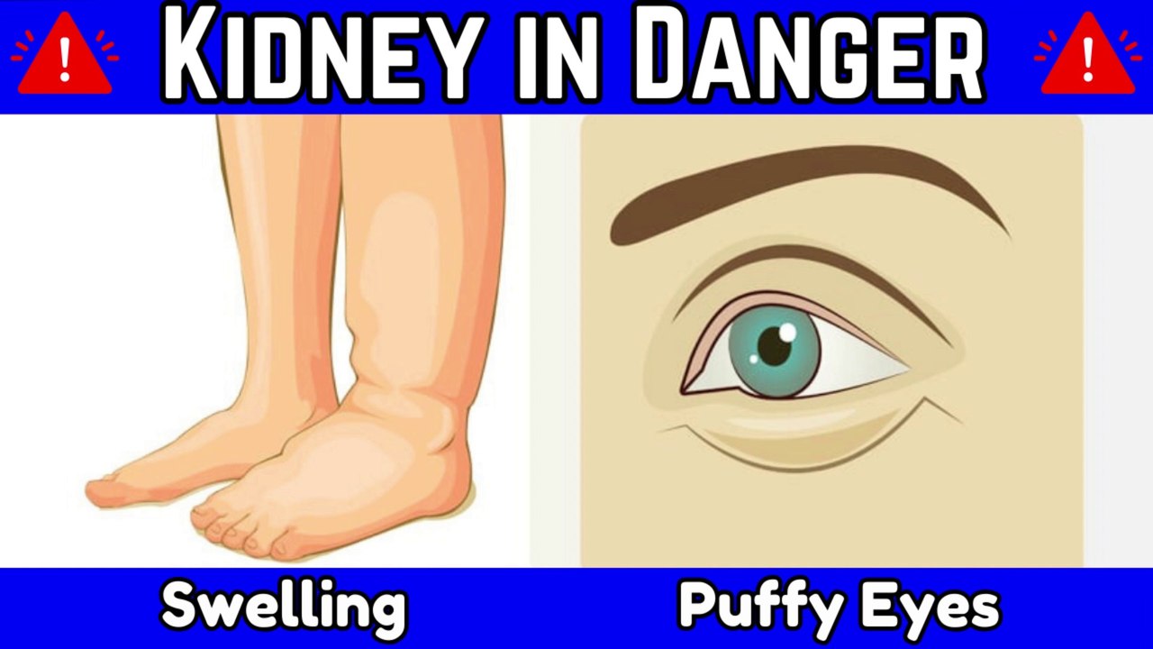 13 crucial warning signs indicating kidney failure