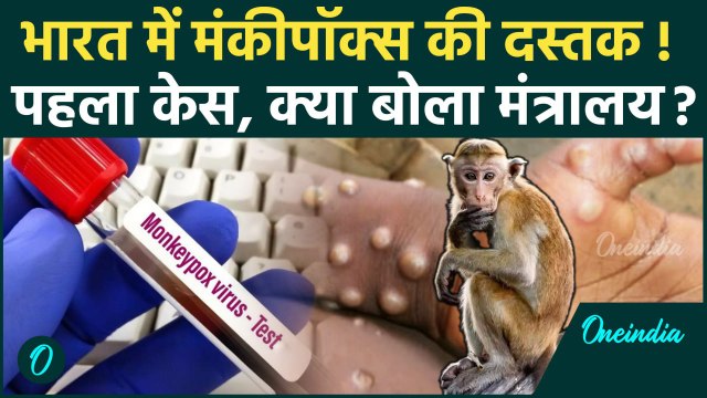 Monkey Pox Virus: देश में मंकीपॉक्स पहला केस | WHO | Mpox | India | PM Modi | वनइंडिया हिंदी