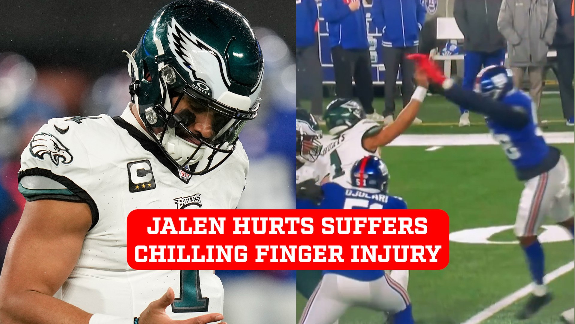 Jalen Hurts suffers gruesome finger injury in disastrous Eagles game