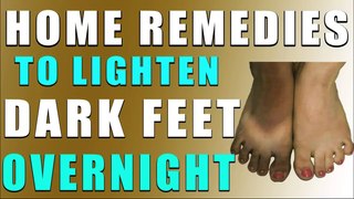 रातोंरात गोरे पैर के पँजे पाने के लिए घरेलू उपाय II HOME REMEDIES TO LIGHTEN DARK FEET OVERNIGHT II