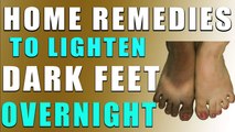 रातोंरात गोरे पैर के पँजे पाने के लिए घरेलू उपाय II HOME REMEDIES TO LIGHTEN DARK FEET OVERNIGHT II