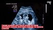 Twins almost kill each other in their mother's womb, doctors forced to induce labour
