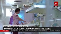Puebla reporta dos casos sospechosos de hepatitis aguda infantil