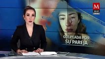 Luchadora nacional Daniela López fue golpeada brutalmente por su ex pareja