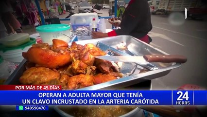 Adulta mayor de 68 años se viene recuperando tras la extracción de un clavo en la arteria carótida