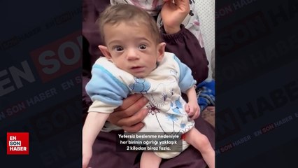 Filistinli bebekler, yetersiz beslenme sebebiyle ölüm tehlikesi ile karşı karşıya