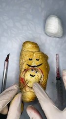 “El doctor de los alimentos” se viraliza por realizar una cesárea a un pan francés 