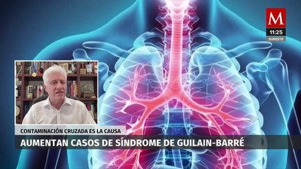 "Aún no se conocen las causas": Dr. Alejandro Macías tras el incremento de casos de Guilain- Barré