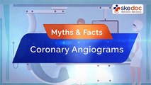 Myths & Facts of Coronary Angiogram | Skedoc