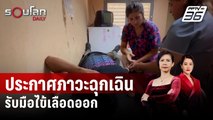 เปอร์โตริโกประกาศภาวะฉุกเฉินรับมือไข้เลือดออกระบาด | รอบโลก DAILY | 30 มี.ค. 67