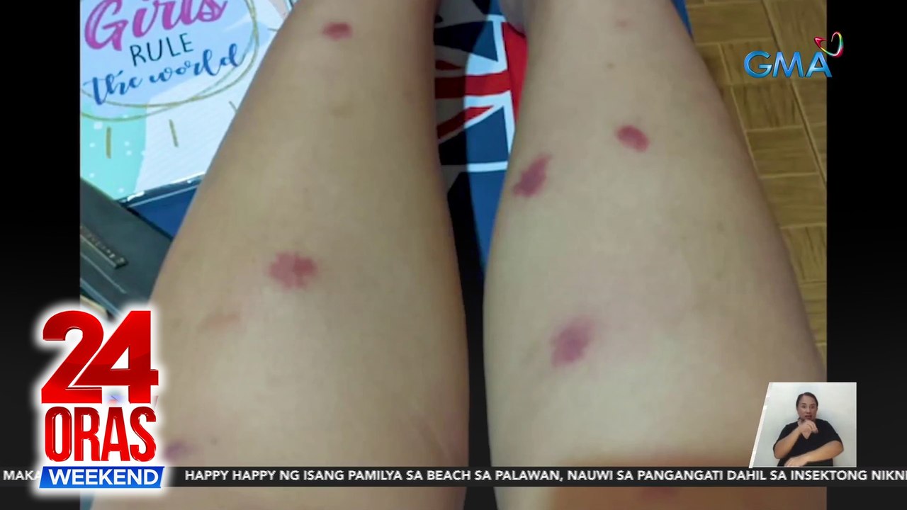 Isang nag-beach sa Palawan, namantal ang katawan dahil sa insektong ...