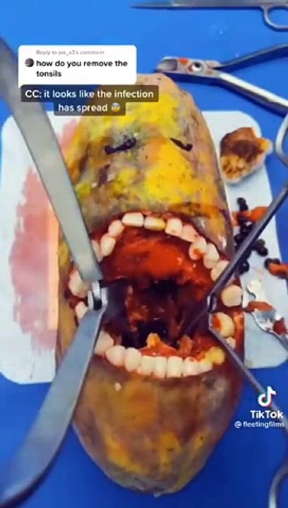 Fruit Surgeries Dentist