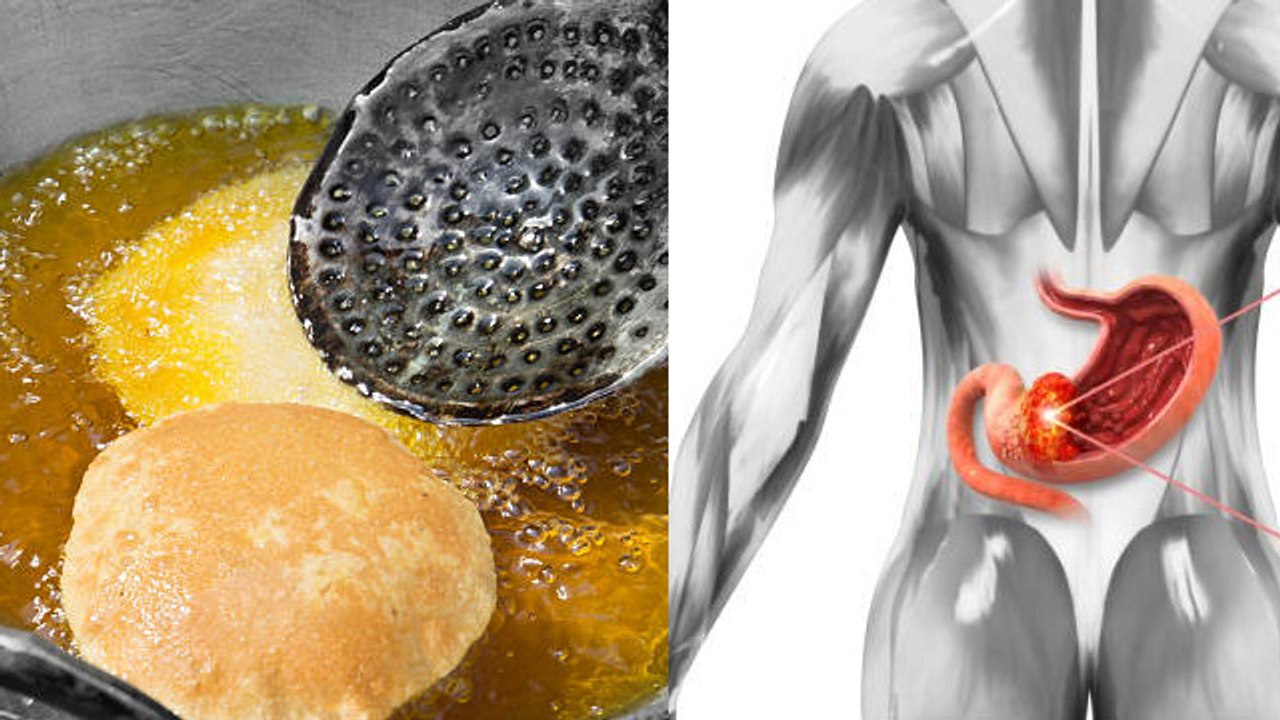 पके तेल को कितनी बार इस्तेमाल कर सकते है | How Many Times We Can Reuse Cooking Oil | Boldsky