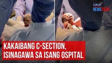 Download Video: Kakaibang C-Section, isinagawa sa isang ospital | GMA Integrated Newsfeed