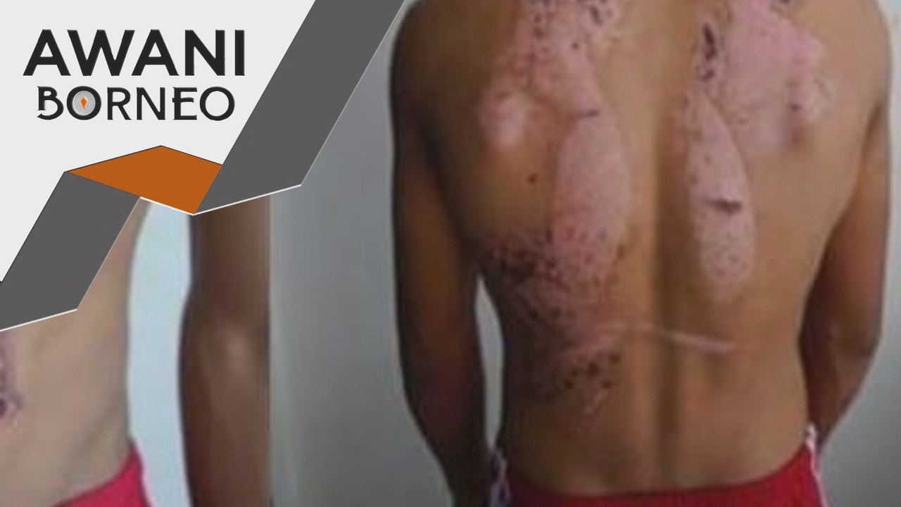 Pasangan suami isteri ditahan disyaki dera dua kanak-kanak