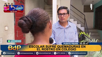 Adolescente extranjera sufre quemaduras en el rostro en colegio de Puente Piedra