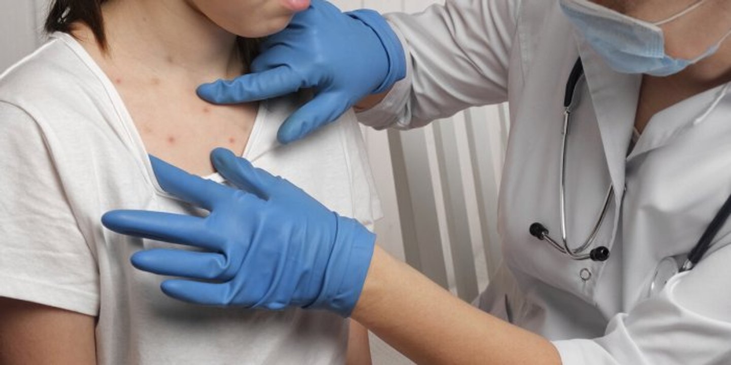 Faut-il craindre une épidémie de rougeole pendant les JO 2024 ?