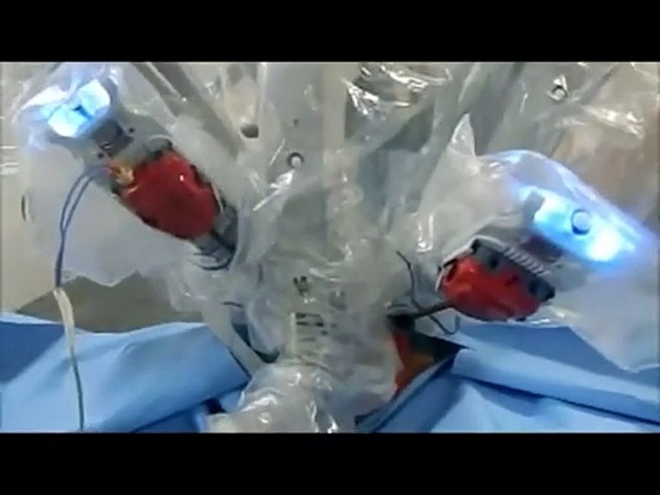 da vinci robotic surgery training for surgeon and gynecologists