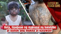 Bata, tinubuan ng makapal na balahibo at buhok ang mukha at katawan! | Kapuso Mo, Jessica Soho