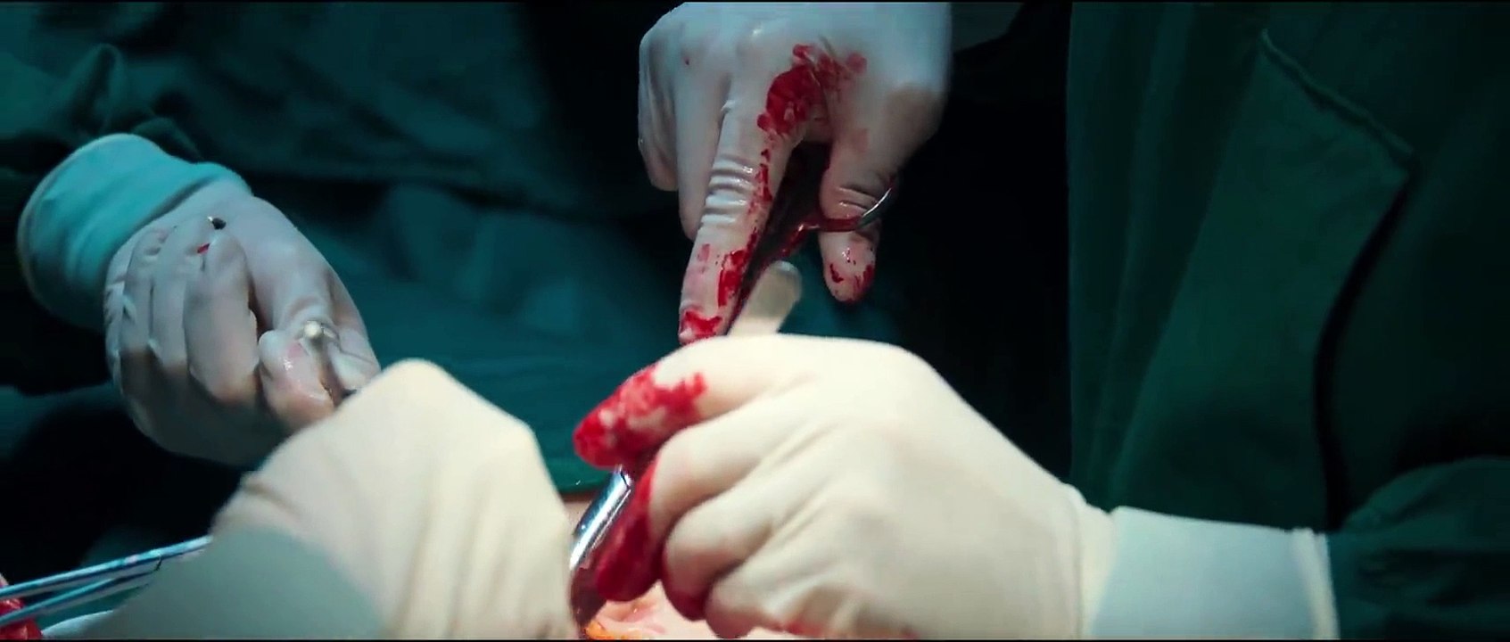 [ENG 5] Live Surgery Room