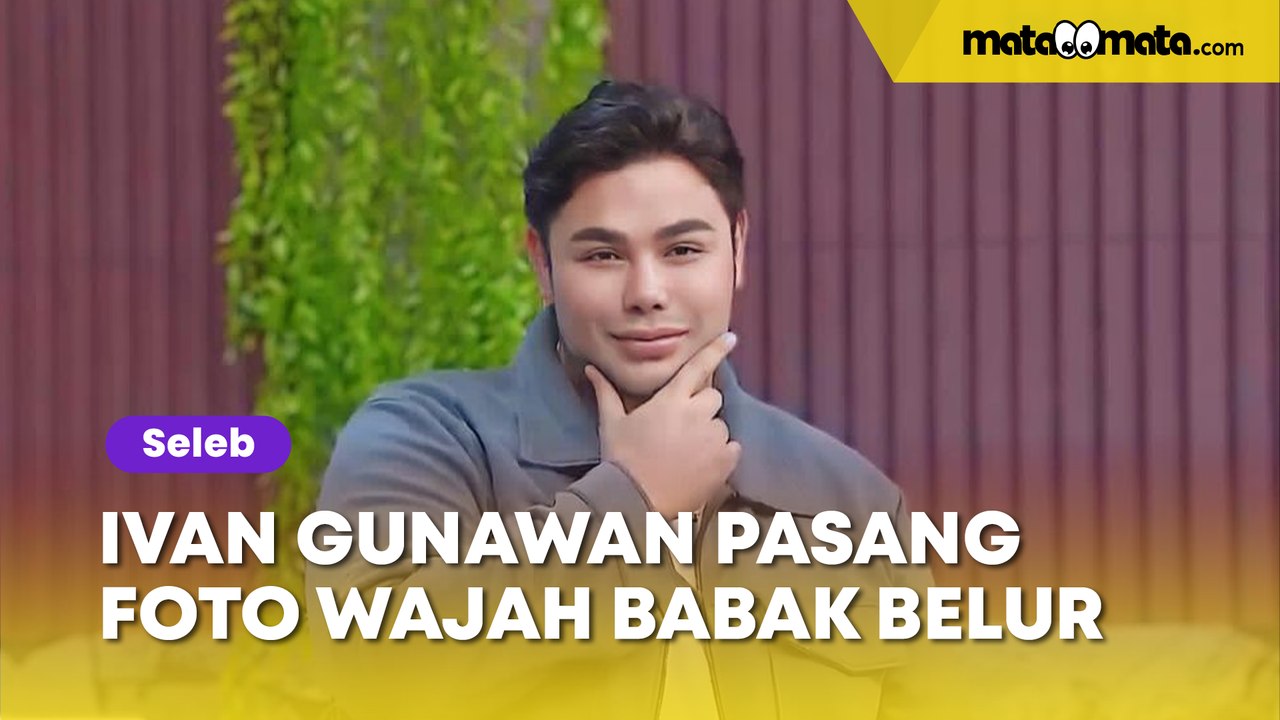 Ivan Gunawan Pasang Foto Wajah Babak Belur dan Singgung Balas Dendam, Ada Apa?