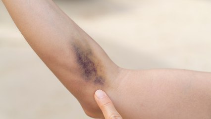 ¿Por qué Sangran Sin Explicación? Descubre las Causas 🚑