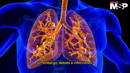 Anosmia: ¿Cómo funciona la pérdida del olfato? - #ExclusivoMSP