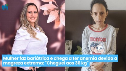 Mulher faz bariátrica e chega a ter anemia devido a magreza extrema: "Cheguei aos 36 kg"