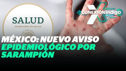 México emite nuevo aviso epidemiológico por sarampión | Reporte Indigo