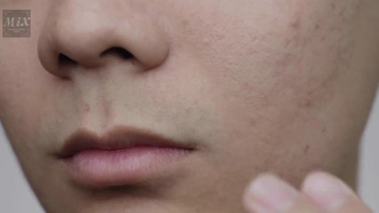 Large pores Myths | Ways to Avoid Large pores #mix #beauty #large_pores