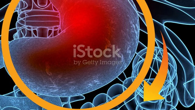 Understanding GERD : Causes Symptoms and Treatments Gastroesophageal Reflux heartburn