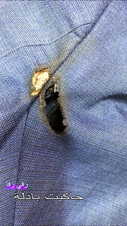 Watch different types of punctures that have been repaired professionally on my channel only.