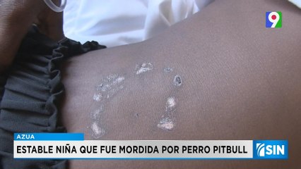 Perro pitbull ataca niña de 8 años en Azua | Primera Emisión SIN