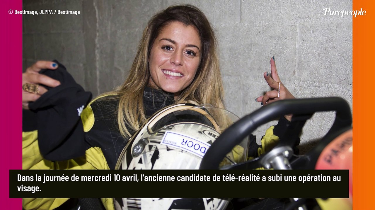 PHOTO Anaïs Camizuli (Secret Story) opérée du visage après son violent passage à tabac, "tout le cartilage était cassé..."